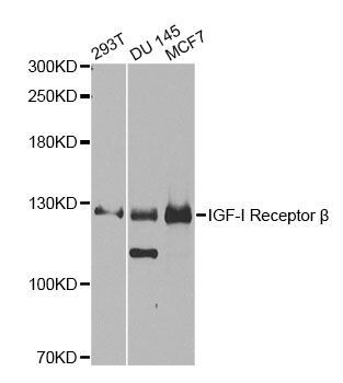 Western blot - IGF1R Polyclonal Antibody (144-00243)