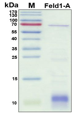 SDS-PAGE