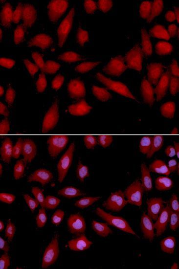 Western blot - PSMA2 Polyclonal Antibody (144-02504)
