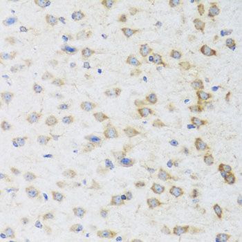 Immunohistochemistry - STRN antibody (144-07734)