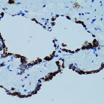 Immunohistochemistry - CTSE antibody (144-02678)