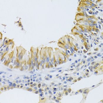 Immunohistochemistry - CASP9 Antibody (144-02636)