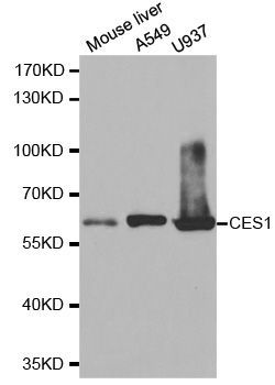Western blot - CES1 antibody (144-01853)