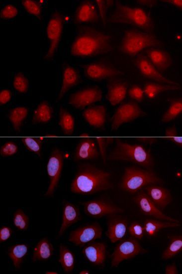 Western blot - [KO Validated] POLB Polyclonal Antibody (144-01681)