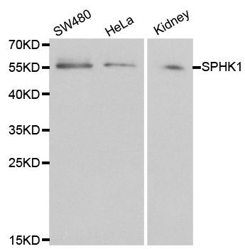 Western blot - SPHK1 Polyclonal Antibody (144-00139)