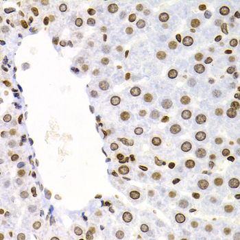 Immunohistochemistry - NFKB2 Polyclonal Antibody (144-03108)