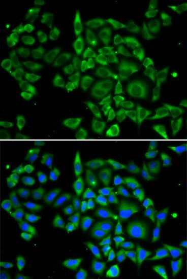 Immunofluorescence - PRKCA Polyclonal Antibody (144-00267)