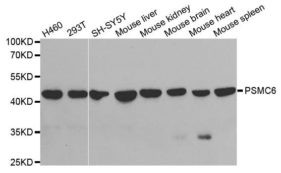 Western blot - PSMC6 antibody (144-05377)