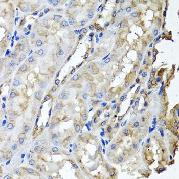Immunohistochemistry - SCYL1 antibody (144-06735)