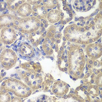 Immunohistochemistry - H6PD Polyclonal Antibody (144-06440)