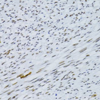 Immunohistochemistry - SNRNP70 antibody (144-06065)