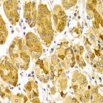 Immunohistochemistry - PRKCE antibody (144-02110)