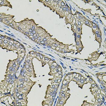 Immunohistochemistry - SMN2 Polyclonal Antibody (144-01652)
