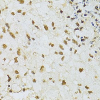 Immunohistochemistry - DDB1 Polyclonal Antibody (144-02896)