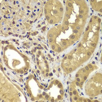 Immunohistochemistry - SORT1 Polyclonal Antibody (144-07926)