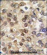 IHC-P