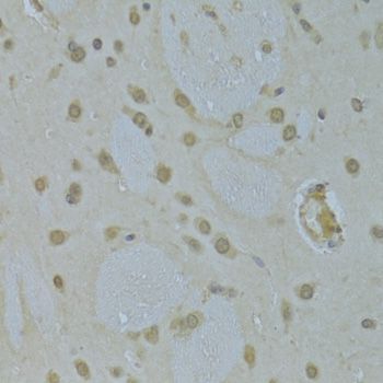 Immunohistochemistry - HNRNPK Antibody (144-01701)