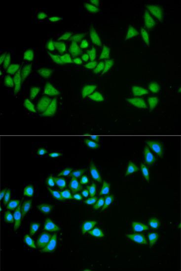 Immunofluorescence - UPF1 antibody (144-01521)