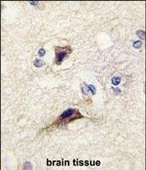 IHC-P