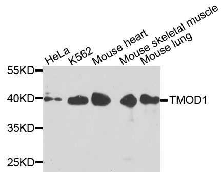 Western blot - TMOD1 antibody (144-04160)