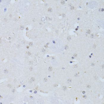 Immunohistochemistry - POLR2A Polyclonal Antibody (144-011181)
