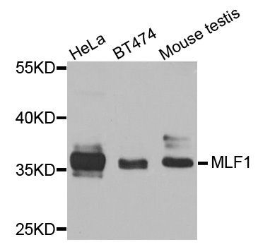 Western blot - MLF1 antibody (144-08012)