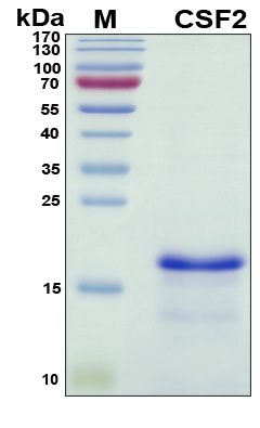 SDS-PAGE