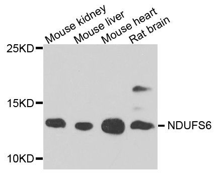Western blot - NDUFS6 antibody (144-03985)