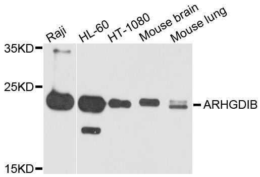 Western blot - ARHGDIB antibody (144-03740)
