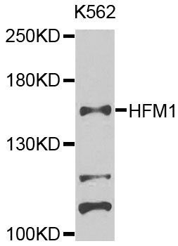 Western blot - HFM1 Polyclonal Antibody (144-08600)