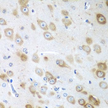 Immunohistochemistry - GFM1 Polyclonal Antibody (144-05077)