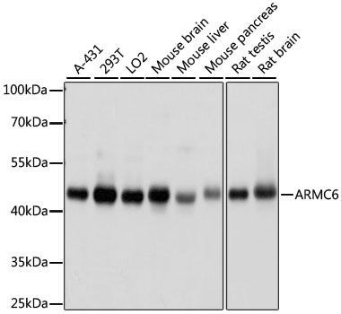 Western blot - ARMC6 antibody (144-015931)