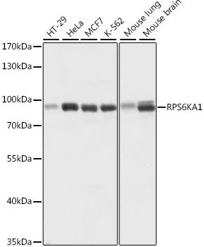 Western blot - P90RSK Polyclonal Antibody (144-015718)