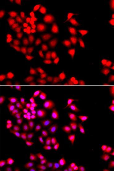 Immunofluorescence - STXBP2 antibody (144-012511)