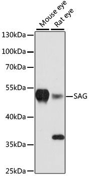 Western blot - SAG antibody (144-60158)