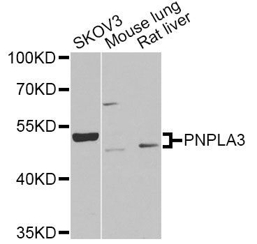 Western blot - PNPLA3 Antibody (144-06694)