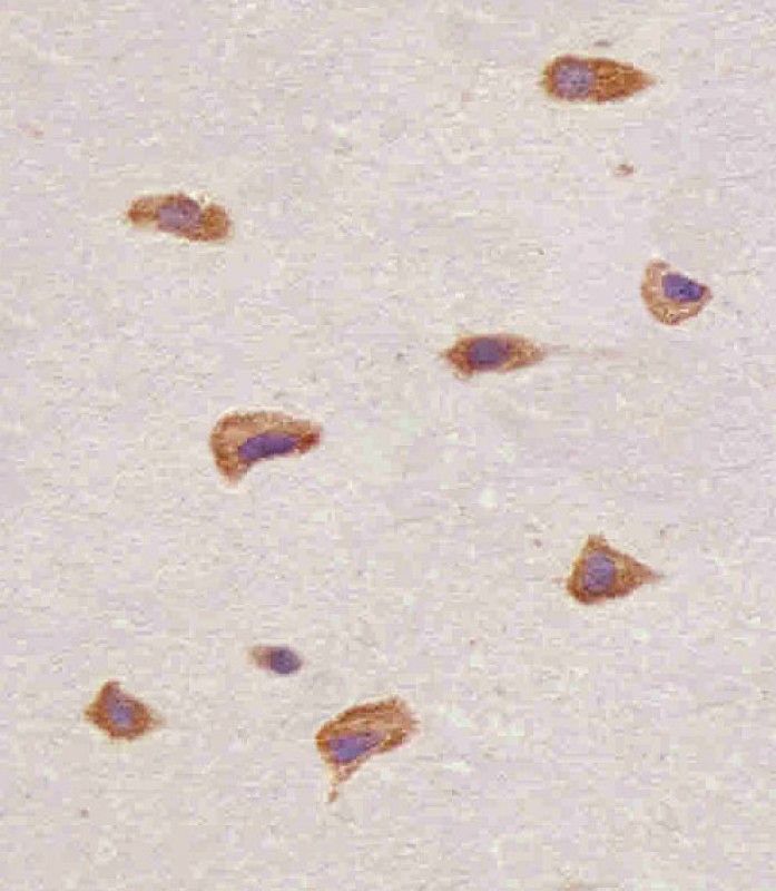 IHC-P
