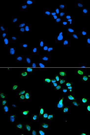 Immunofluorescence - IRF5 antibody (144-01149)