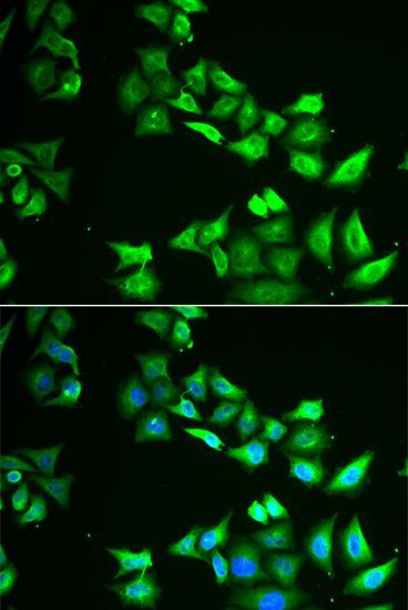 Immunofluorescence - CCBL1 Polyclonal Antibody (144-06542)