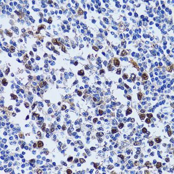 Immunohistochemistry - UHRF1 antibody (144-02343)