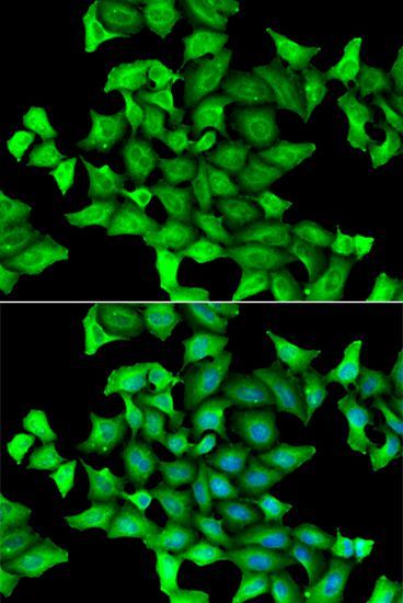 Immunofluorescence - SEPSECS Polyclonal Antibody (144-07103)