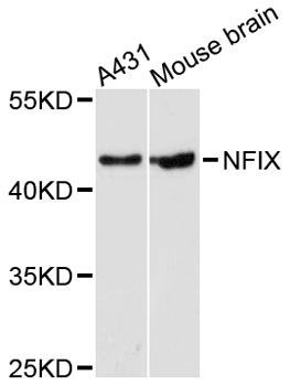 Western blot - NFIX antibody (144-09390)