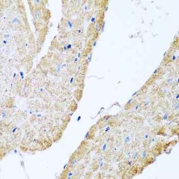Immunohistochemistry - COX6B1 antibody (144-02641)