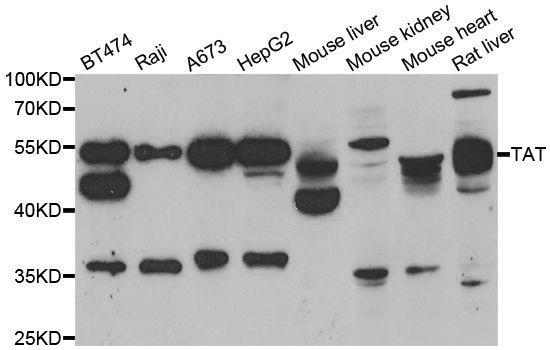 Western blot - TAT antibody (144-06764)