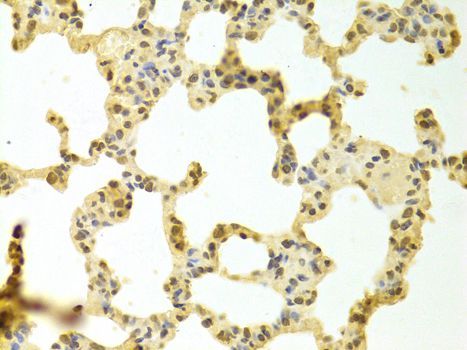 Immunohistochemistry - HNRNPK Antibody (144-01701)
