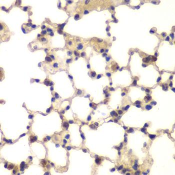 Immunohistochemistry - CXXC1 antibody (144-05814)
