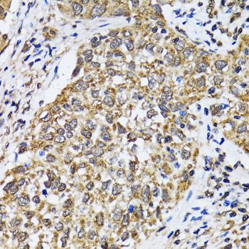Immunohistochemistry - TP53 Polyclonal Antibody (144-05761)
