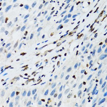 Immunohistochemistry - FLI1 Polyclonal Antibody (144-05644)
