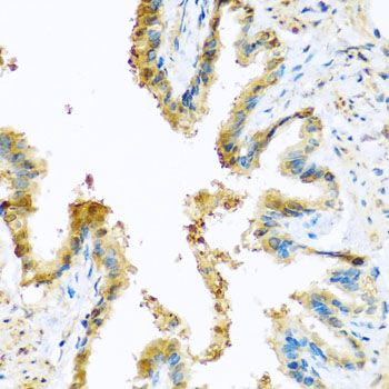 Immunohistochemistry - KCTD15 antibody (144-08256)