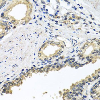 Immunohistochemistry - STXBP2 antibody (144-07735)